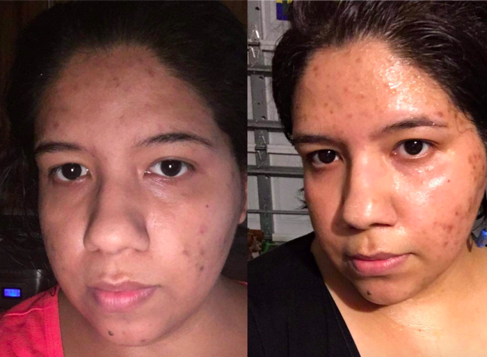 A customer’s before-and-after photo showing the effects of using the serum