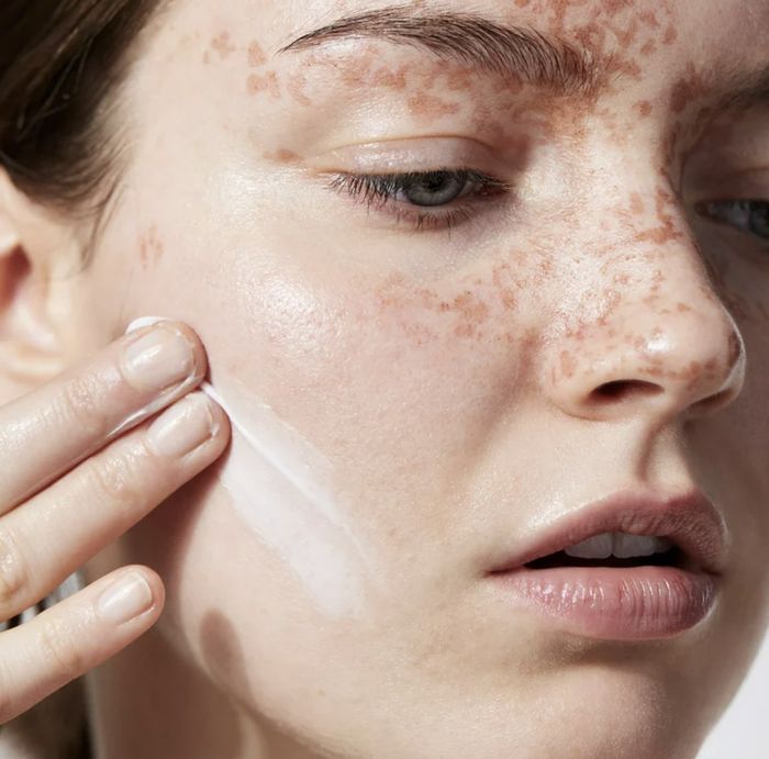 A person is applying cream to their skin.