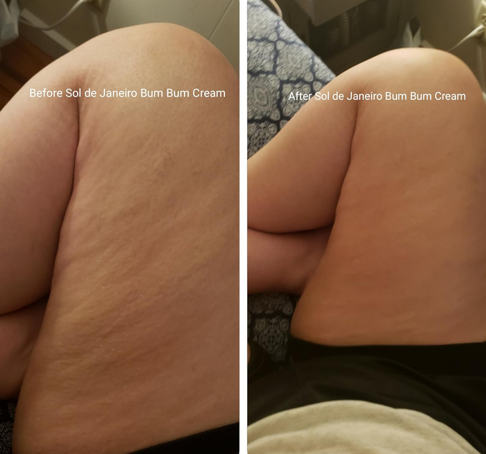 Before-and-after images showcasing the transformation of a person's thigh after using Sol de Janeiro Bum Bum Cream.