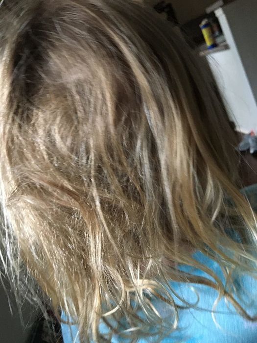 Reviewer image of a child's hair tangled and matted