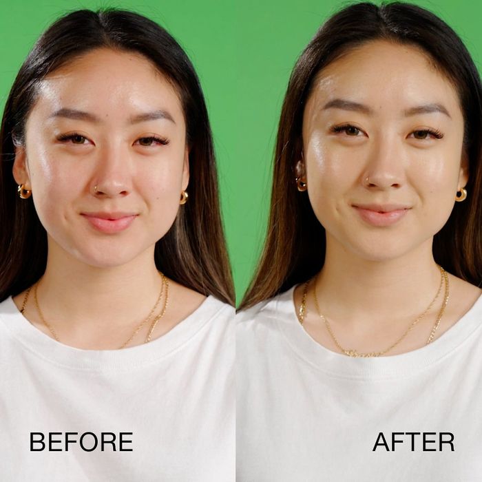 On the left, a model with mild redness is labeled "before," while on the right, the same model displays a flawless complexion labeled "after."