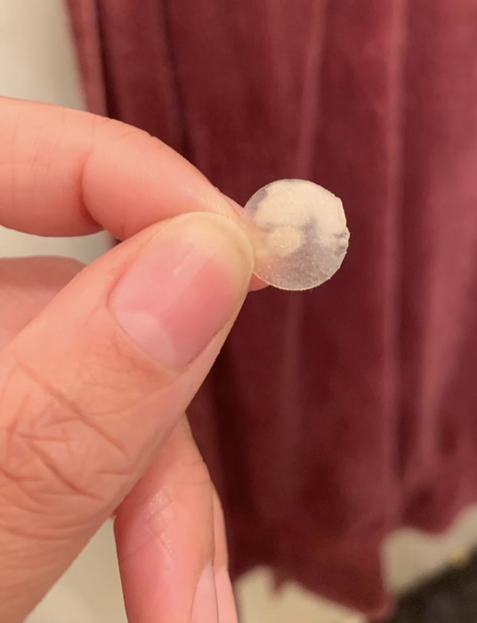 The reviewer is holding a used acne patch.