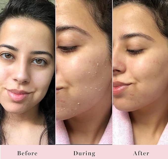 A three-part facial skincare transformation showing a woman before, during, and after using the product, with noticeable improvement in her skin texture.