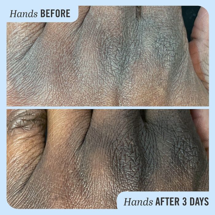 A before-and-after photo of the model using the cream on their knuckles, showing visible hydration improvement.