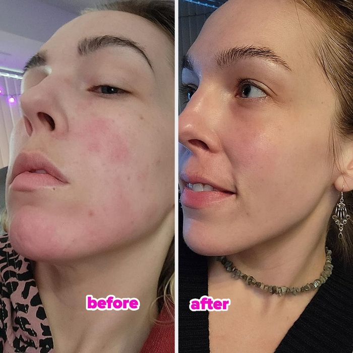 Before and after photos of the reviewer showing the effects of using rose water