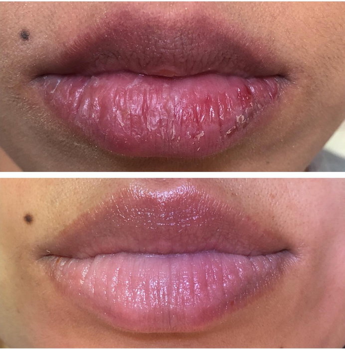 A before-and-after photo of the reviewer’s lips, showing dry, cracked lips transformed into moisturized and healthy-looking lips after using the balm.