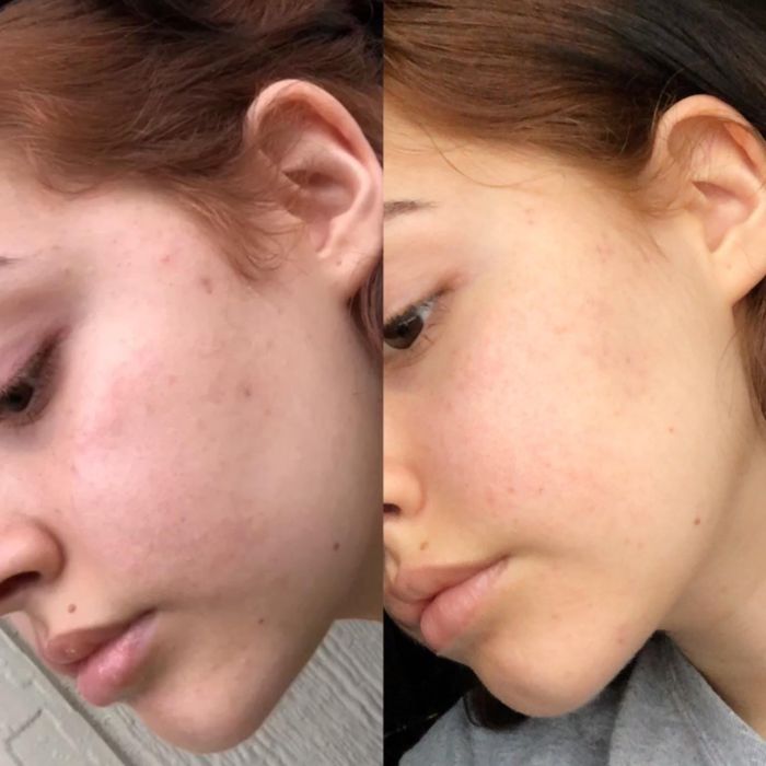 After using the toner, the reviewer's skin appears brighter and more radiant.