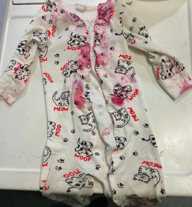 Clothes with visible stains before applying the stain remover.