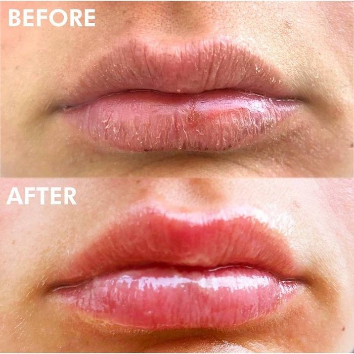 Before and after photo showing the effect of using the lip product