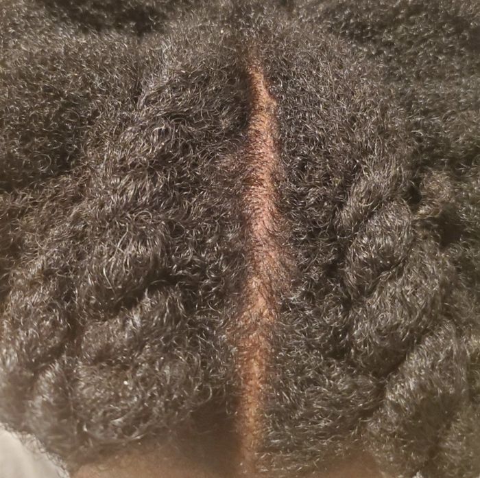a person showcasing a flake-free scalp after shampoo use