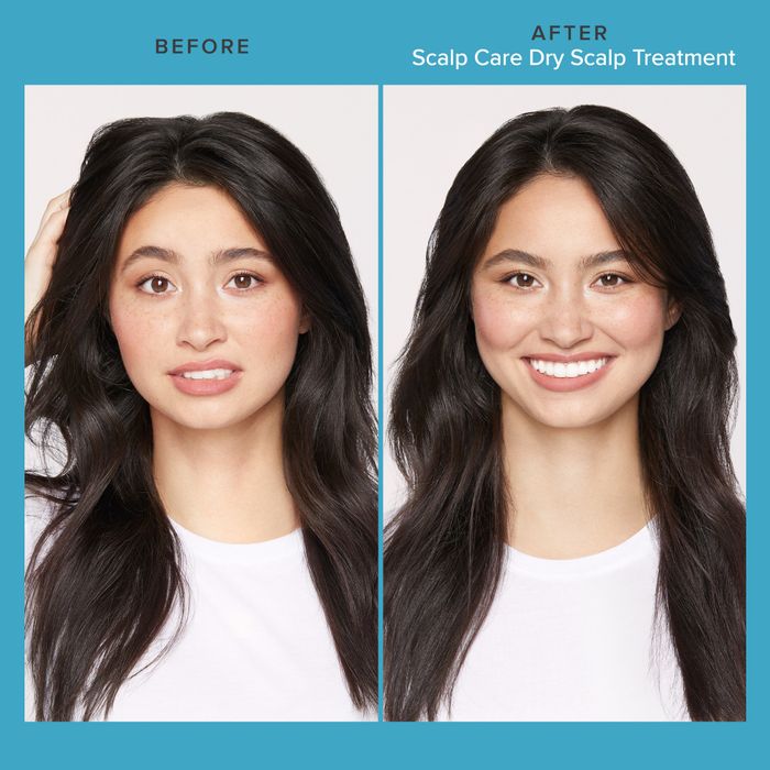 A comparison image of a person with dry, flaky hair before treatment and smooth, healthy hair after using the product.