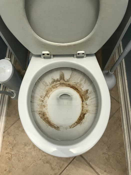 Image showing a stained toilet bowl before cleaning