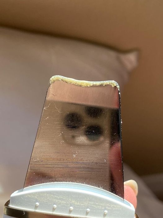 A close-up of the scraper showing accumulated dead skin and sebum.