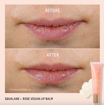 Before and after showing a model's chapped lips transformed into hydrated lips.