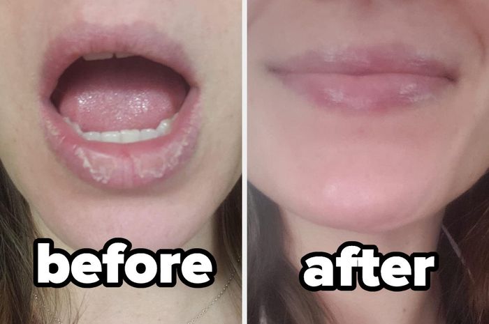 A reviewer's before and after showing cracked, peeling lips transformed into smooth, hydrated lips.