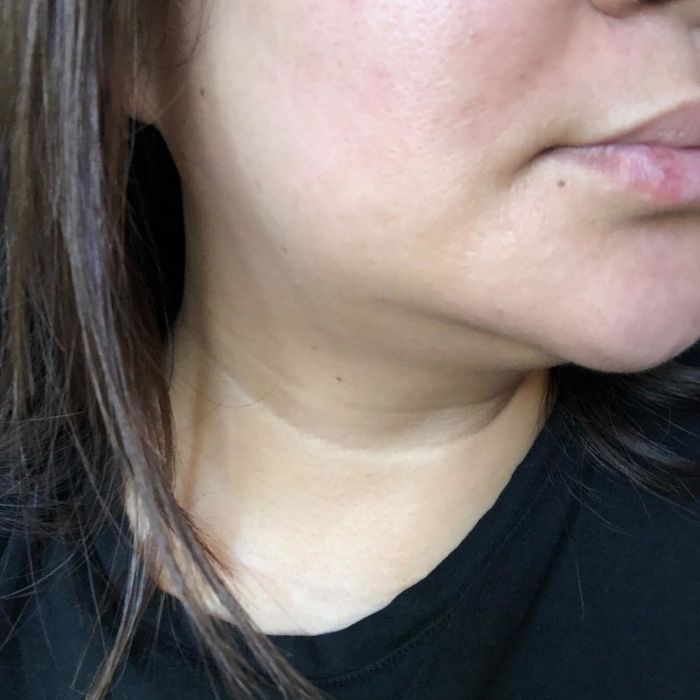 An image of the same reviewer with a completely clear face, free from scars