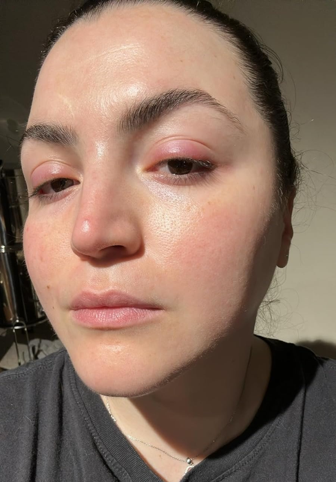 The same reviewer now has clear, radiant, and calm skin.