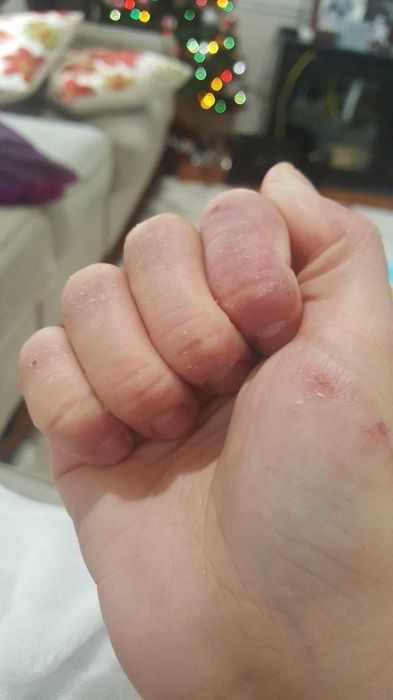 Reviewer photo showing hands visibly healed and rehydrated after using the hand cream.