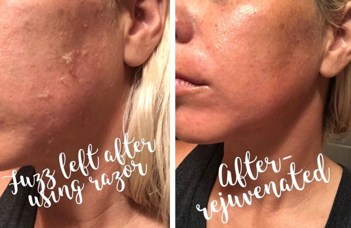 A reviewer's before-and-after photos showing the results of using a razor on their face.