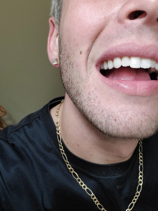 A reviewer's photo showing a person opening their mouth to reveal their clean, white teeth.