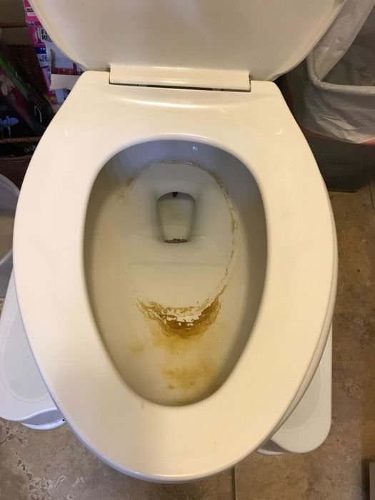 A reviewer's photo of their toilet bowl, showcasing dark yellow and brown stains before cleaning.