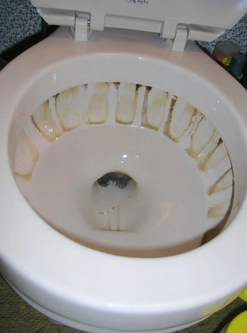 A before photo showing a toilet with visible limestone and calcium buildup