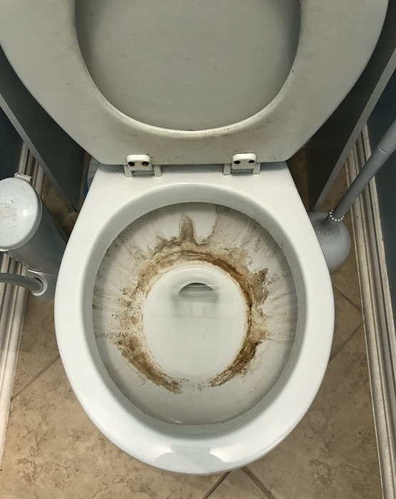 An image showing a stained toilet bowl before cleaning.