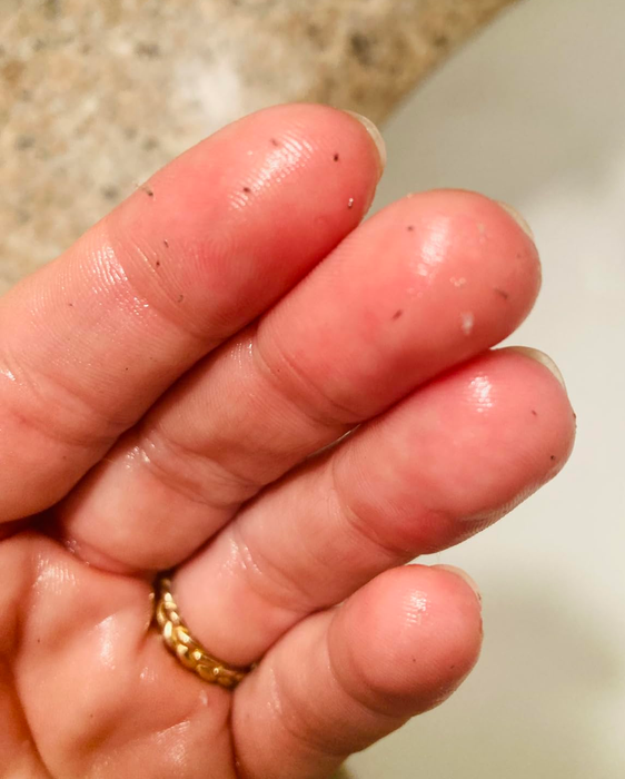 Blackheads and impurities removed from a reviewer’s face after using the cleansing oil.