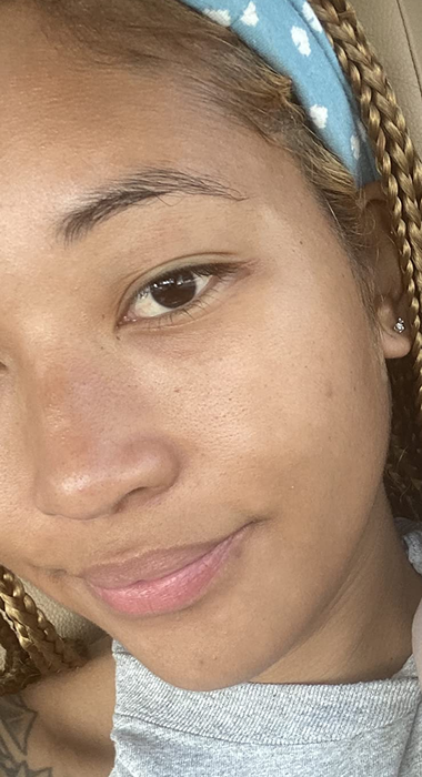 A reviewer proudly displaying their clear, healthy skin.