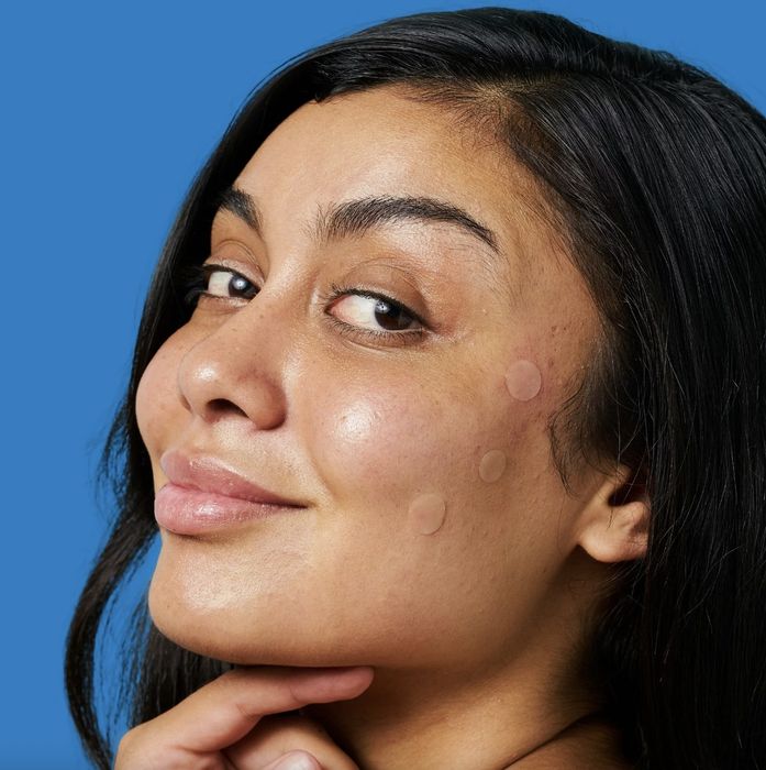A person applying acne treatment patches to their skin.