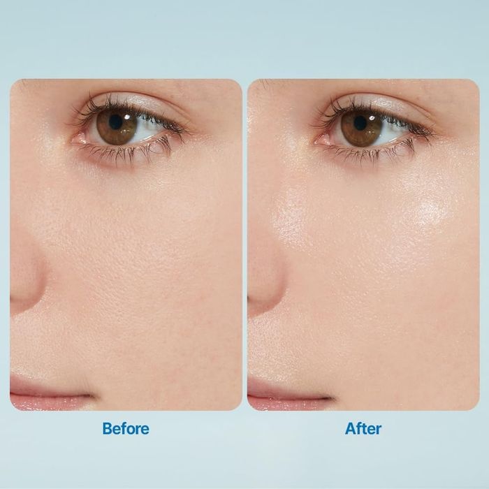 A close-up shot of a person's cheek and eye area, focusing on their skin texture.