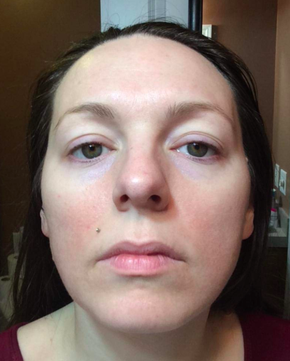 A reviewer’s photo showing their skin less red and more even-toned