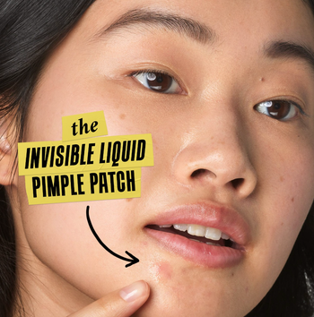 A model applying the invisible acne serum
