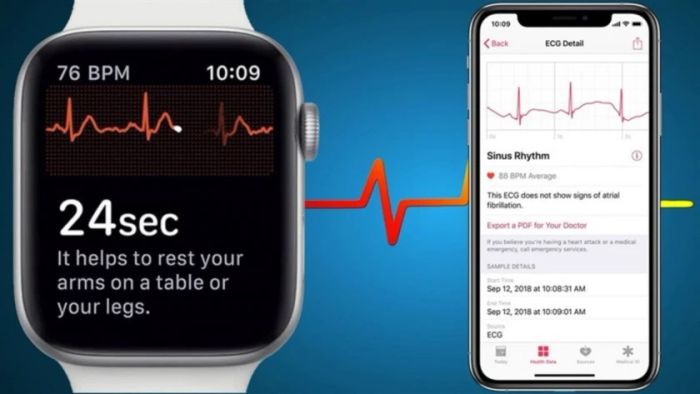 Apple Watch có đo nhịp tim chính xác không và cách tắt tính năng đo nhịp tim.