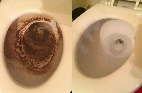 A reviewer's toilet before and after cleaning—showcasing the dramatic removal of heavy rust-colored stains, revealing a sparkling clean bowl.