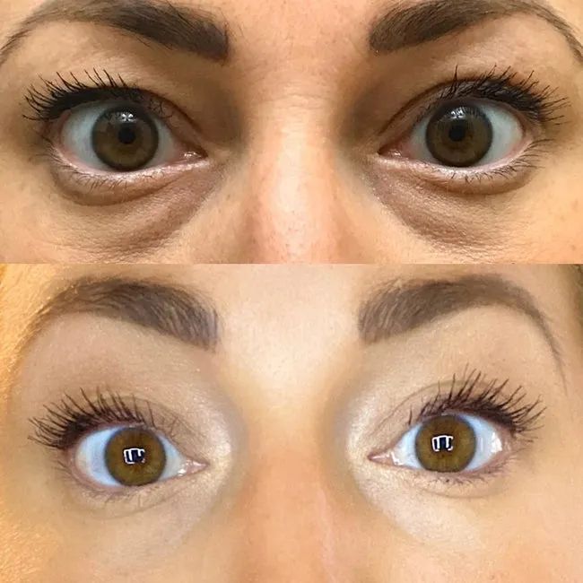 A reviewer showcases before and after results of using the Maybelline Instant Rewind Eraser Dark Circles Treatment Concealer.