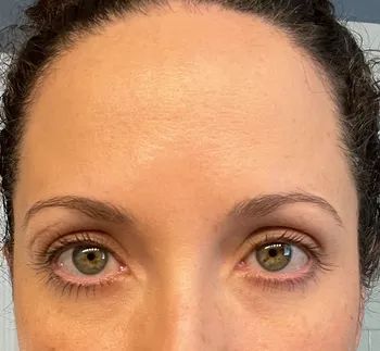 The same reviewer, now with a matte, shine-free forehead after using the makeup primer.