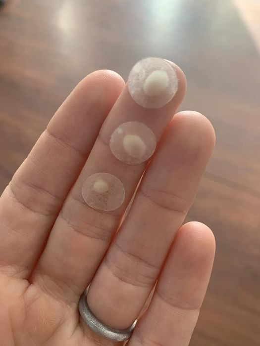 Reviewer with three pus-filled Mighty Patches on their finger.