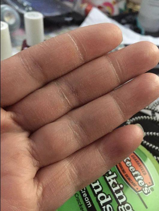 A reviewer showing their dry hands before using the product.