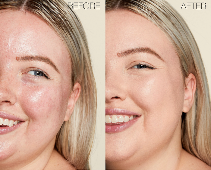 A before-and-after comparison showing a model with redness in the first photo and a flawless complexion after applying the concealer to cover it.