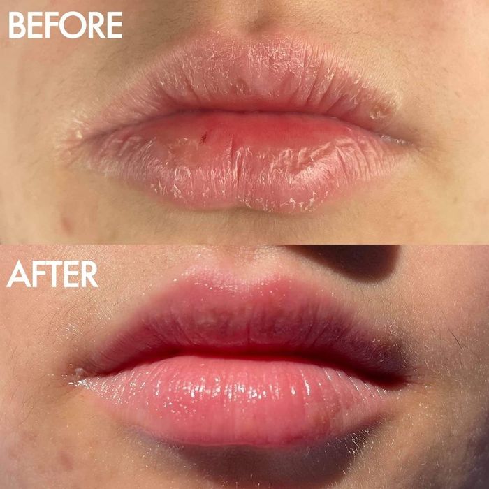 Lips before and after applying Lanolips Balm
