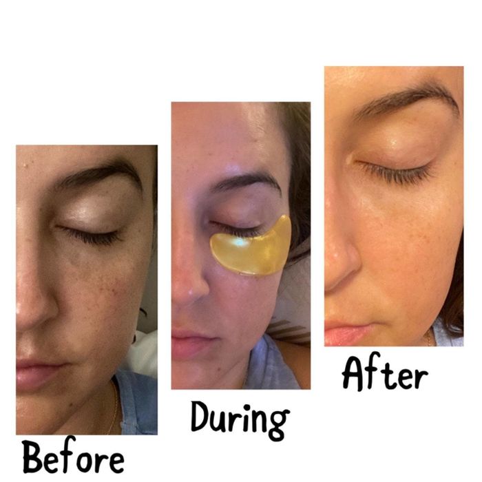 a reviewer showing before, during, and after using under eye patches
