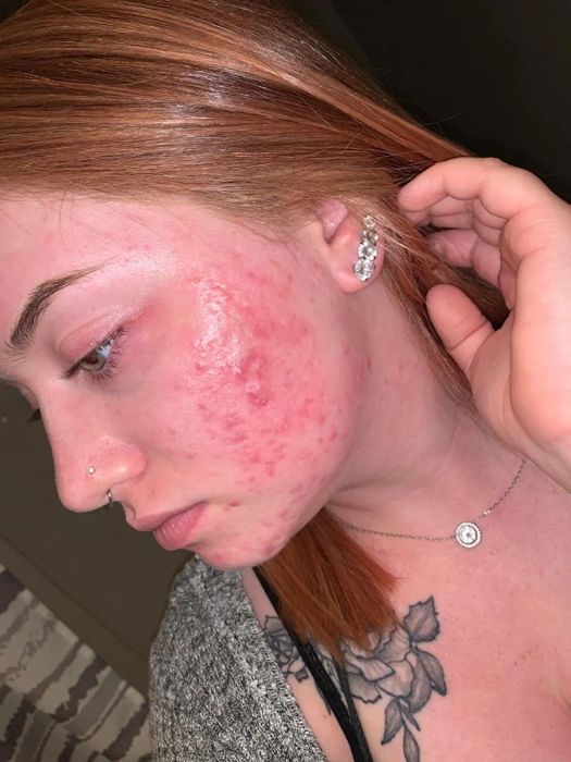Reviewer showing their face before applying foundation