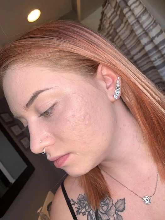 Reviewer showing their face after applying foundation