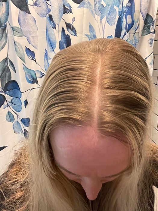 The same reviewer showcasing their hair looking fresh and non-greasy after using the powder.