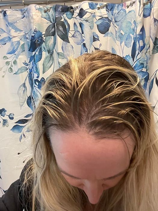 A reviewer displaying their greasy hair before using the dry shampoo.