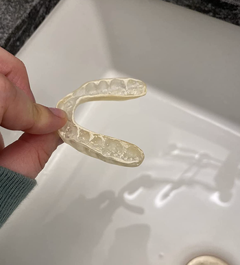 A before photo of a reviewer's dirty retainer