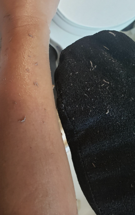 A customer review photo displaying the exfoliated dead skin both on their arm and the mitt itself