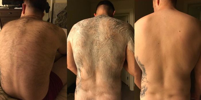 Before and after images from a reviewer showing the results of the hair removal gel on their back
