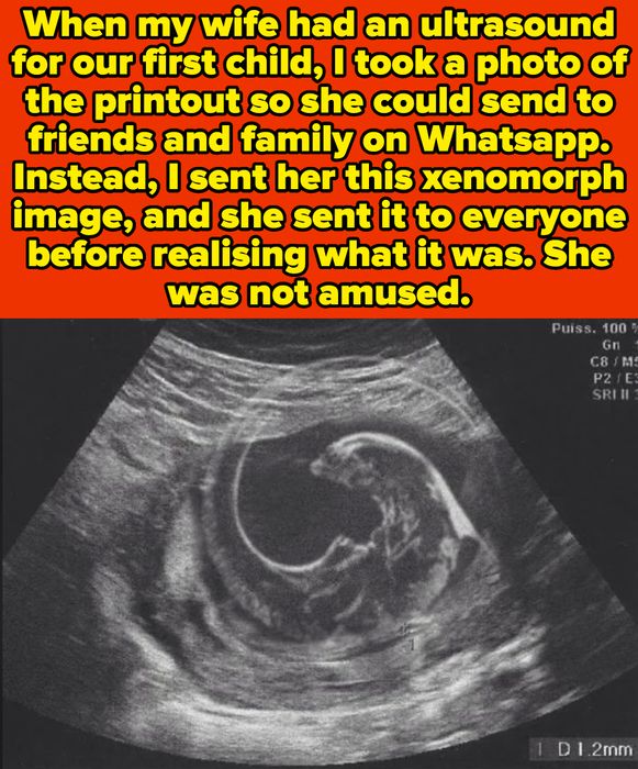 An ultrasound image humorously resembling a xenomorph, shared with family with a lighthearted description of the playful mix-up